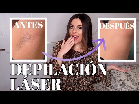 Descubre si el láser funciona para ti ¡Conoce cómo saber si el tratamiento es efectivo!